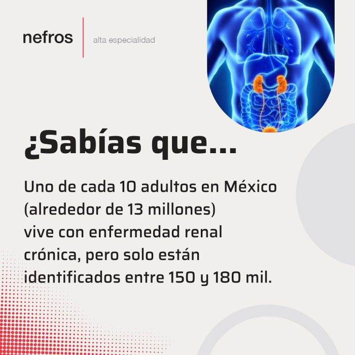 Alrededor de 13 millones de mexicanos padecen una enfermedad renal crónica. ???? 
Es fundamental la prevención de estas patologías, a través de un estilo de vida saludable y revisiones periódicas con tu médico de confianza. ?????????

Síguenos para conocer tips y recomendaciones. ??

#nefrologia #hemodialisis #renal #medicina #dialisis #sauderenal #trasplanterenal #nefro #pacienterenal #sauderenal #renalcronico #salud